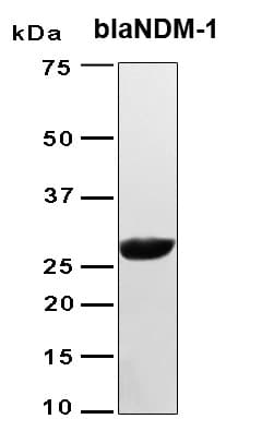 Bacteria blaNDM-1 / Metallo-beta-Lactam Protein (Recombinant 6His, N-terminus)