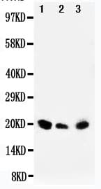 Polyclonal Rabbit anti-Human DUSP3 / VHR Antibody (aa155-171, WB)