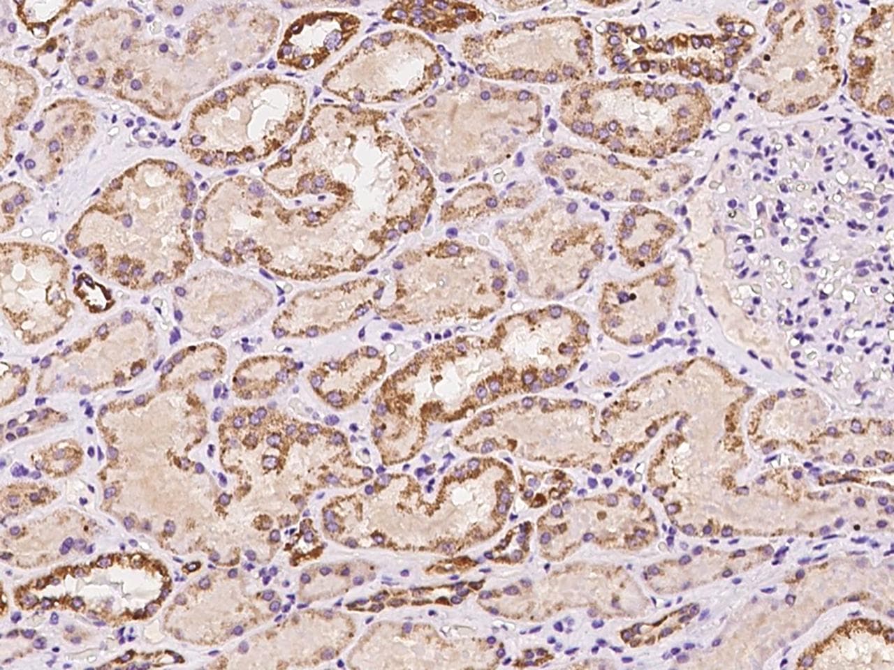 KIAA0828 / AHCYL2 Antibody
