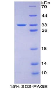 Mouse PRKD1 / PKC Mu Protein (Recombinant His-T7)
