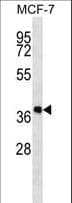 DHRS7B Antibody (aa133-161)