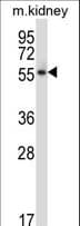PLK5 Antibody (aa4-31)