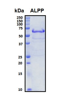 Human PLAP / Alkaline Phosphatase Protein (Recombinant His, N-Terminal)