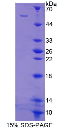 Human DOK3 Protein (Recombinant His-GST-S)