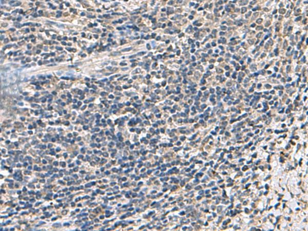 ATP5D Antibody