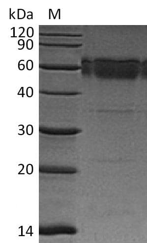 Mouse TNFRSF10B / Killer / DR5 Protein (Recombinant Fc, C-terminus)