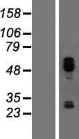 IER5 Protein (Over-Expression Lysate Myc-DDK (Flag))