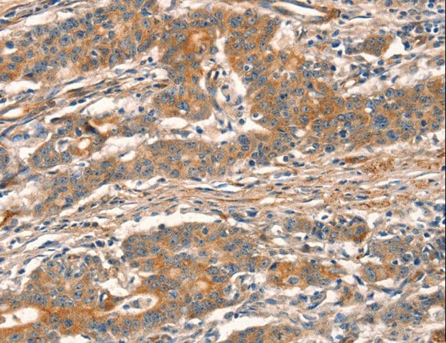 Polyclonal Rabbit anti-Human CUEDC2 Antibody (IHC)