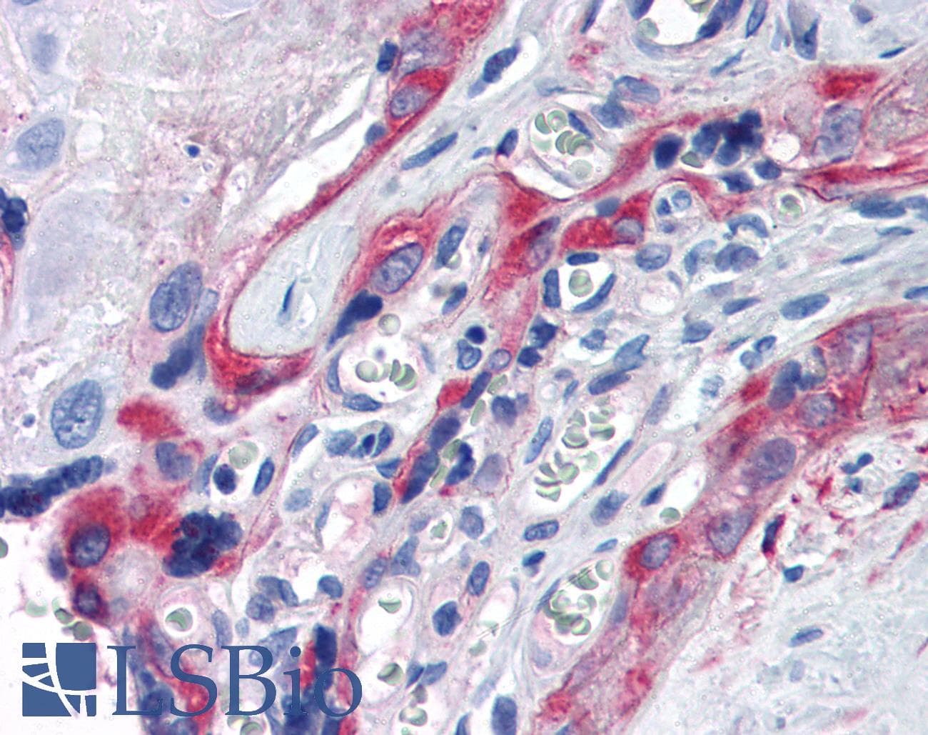 IHC-plus™ TGM2 / Transglutaminase 2 Antibody (Azide-free)