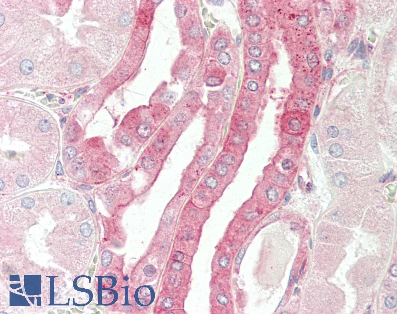 IHC-plus™ CELF3 Antibody (aa3-32)