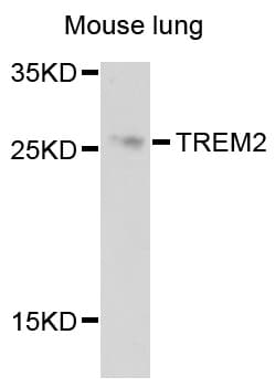 TREM2 / TREM-2 Antibody