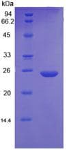 Pig CRP / C-Reactive Protein (Recombinant His, N-Terminal)