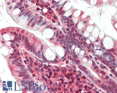 IHC-plus™ Polyclonal Rabbit anti-Human PTPRF Antibody (IHC, WB)