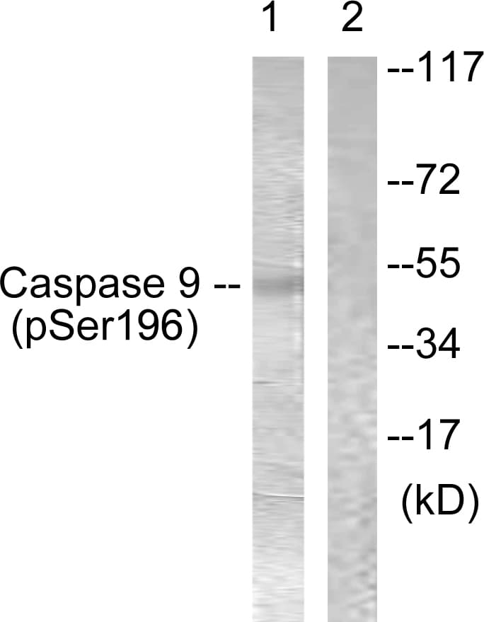 CASP9 / Caspase 9 Antibody (phospho-Ser196)