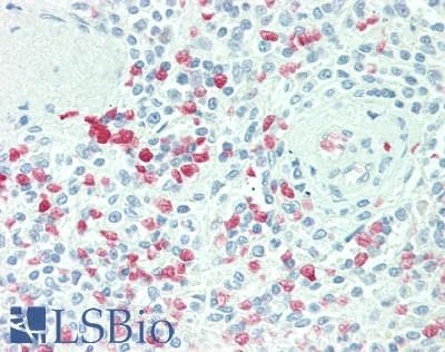 CDKN2D / p19 INK4d Antibody