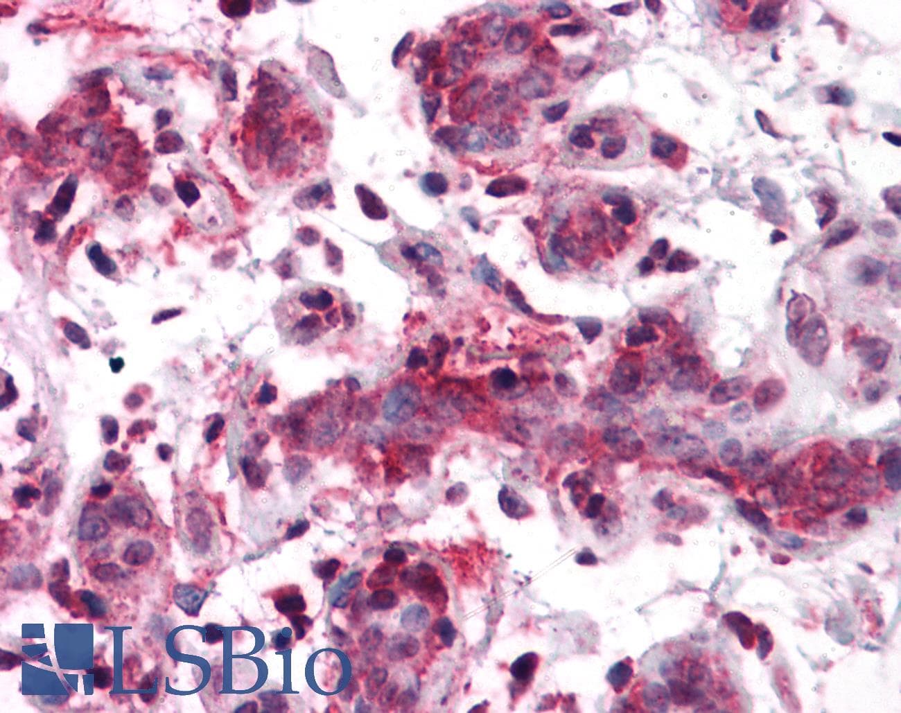 RSPO1 / RSPO Antibody