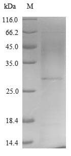 Vaccinia Virus Smallpox-A27L Protein (Recombinant 6His, N-terminus)