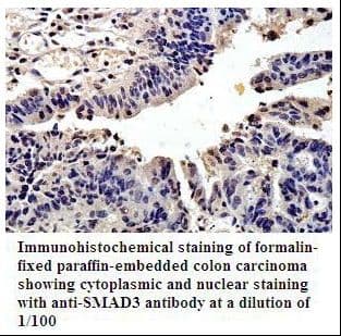 Polyclonal Rabbit anti-Human SMAD3 Antibody (aa1-284, IHC, WB)