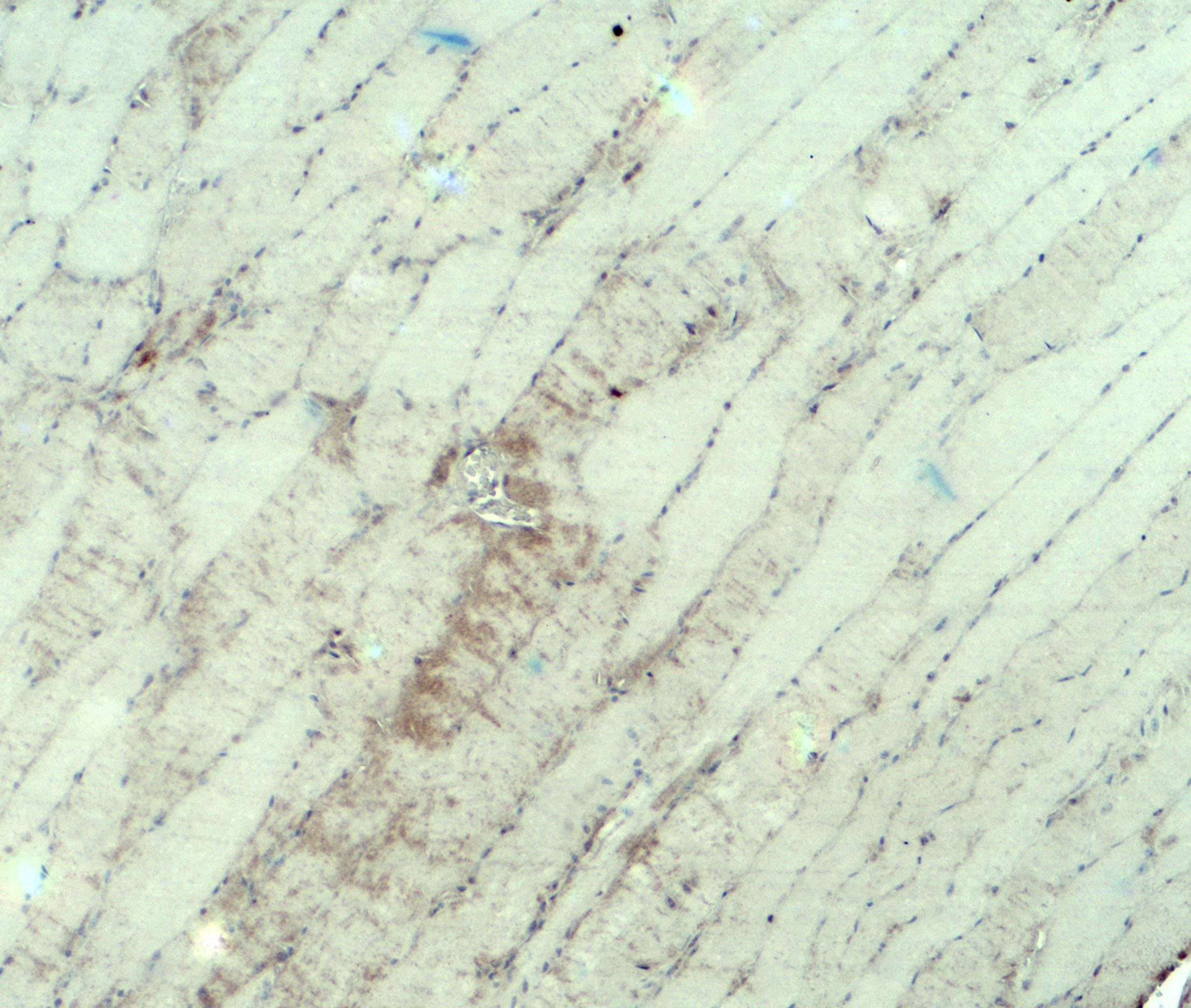 Polyclonal Rabbit anti-Human MYH3 Antibody (IHC, WB)
