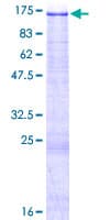 Human PTK2B / PYK2 Protein (Recombinant GST)