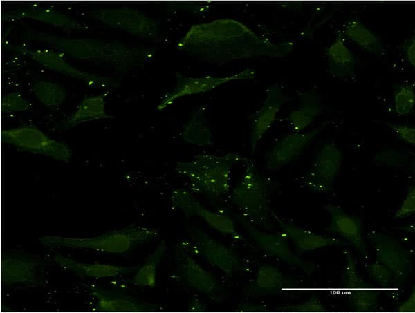 CCL17 / TARC Antibody (aa24-94, clone 1F11)