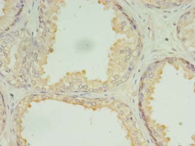 DRC7 / CCDC135 Antibody