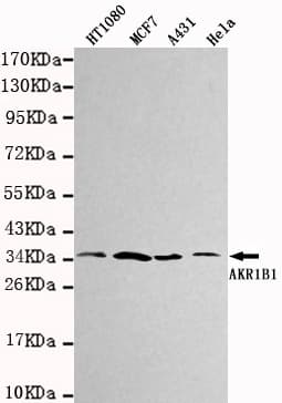 Monoclonal Mouse anti-Human AKR1B1 / Aldose Reductase Antibody (WB)