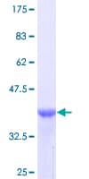 Human TNC / Tenascin C Protein (Recombinant GST, N-terminus)