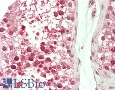 IHC-plus™ ACTL7A Antibody (aa1-435)