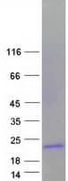 Human TFF1 / pS2 Protein (Recombinant Myc-DDK (Flag))