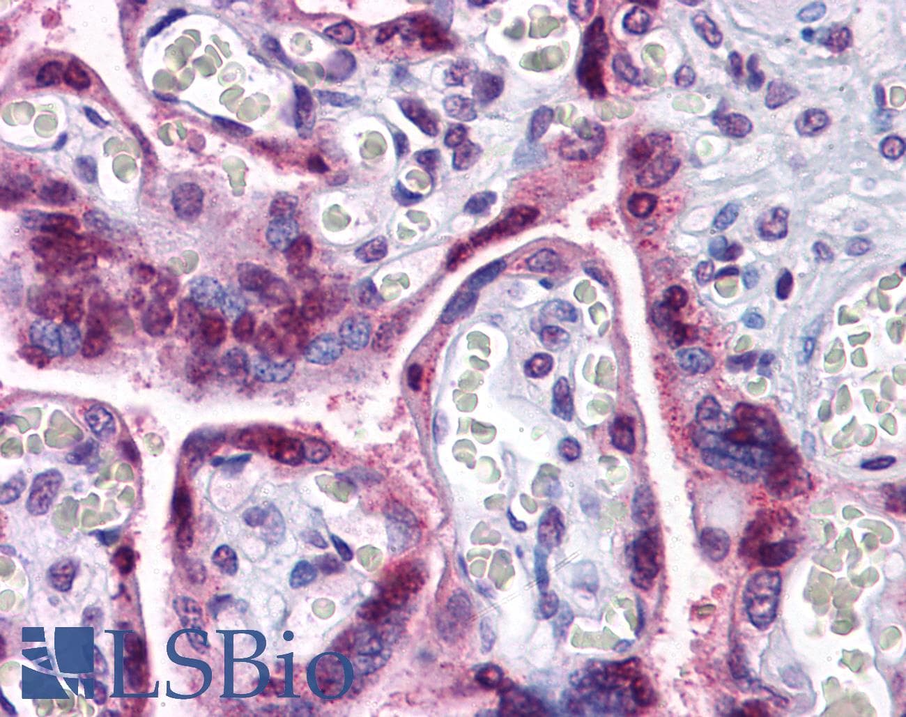 IHC-plus™ Polyclonal Rabbit anti-Human TCF12 / HEB Antibody (IHC, WB)