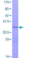 Human ZNF697 Protein (Recombinant GST)
