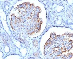 WT1 / Wilms Tumor 1 Antibody (clone RMWT1-1)