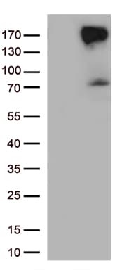 Monoclonal Mouse anti-Human ERBB4 / HER4 Antibody (clone OTI1H6, aa992-1308, IHC, WB)