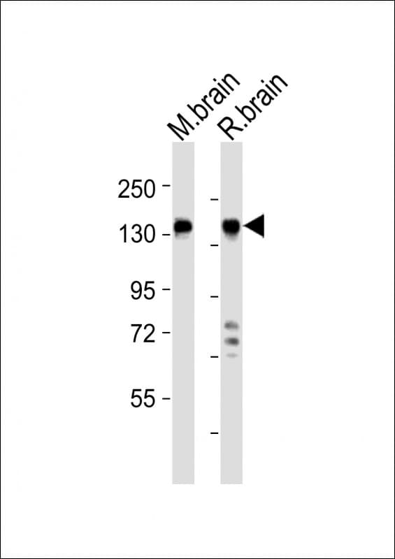 MAGI2 / AIP-1 Antibody (aa1123-1156)