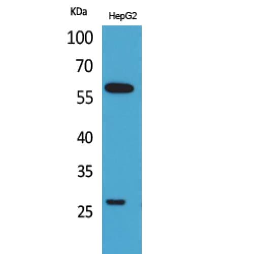 GGT1 / GGT Antibody (11-60 aa, N-terminal)