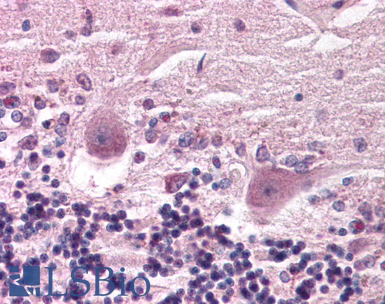 Yo / CDR2 Antibody (C-Terminus, Biotin)