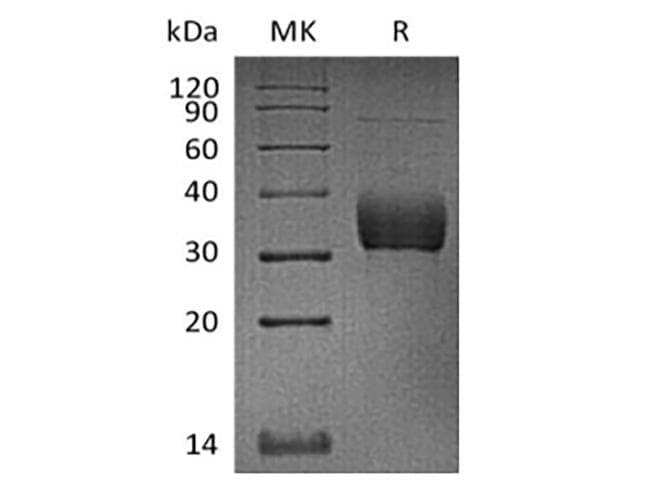 Cynomolgus ANGPTL4 Protein (Recombinant 6His, C-terminus)