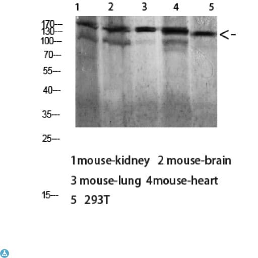 DSG1 / Desmoglein 1 Antibody