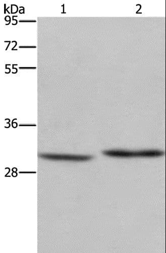 DHRS3 / SDR1 Antibody