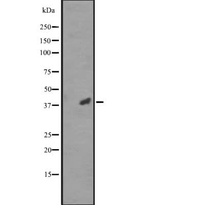 Polyclonal Rabbit anti-Human CDK20 / CCRK Antibody (WB)
