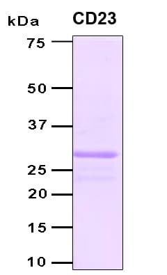 Human FCER2 / CD23 Protein (Recombinant 6His, N-terminus)