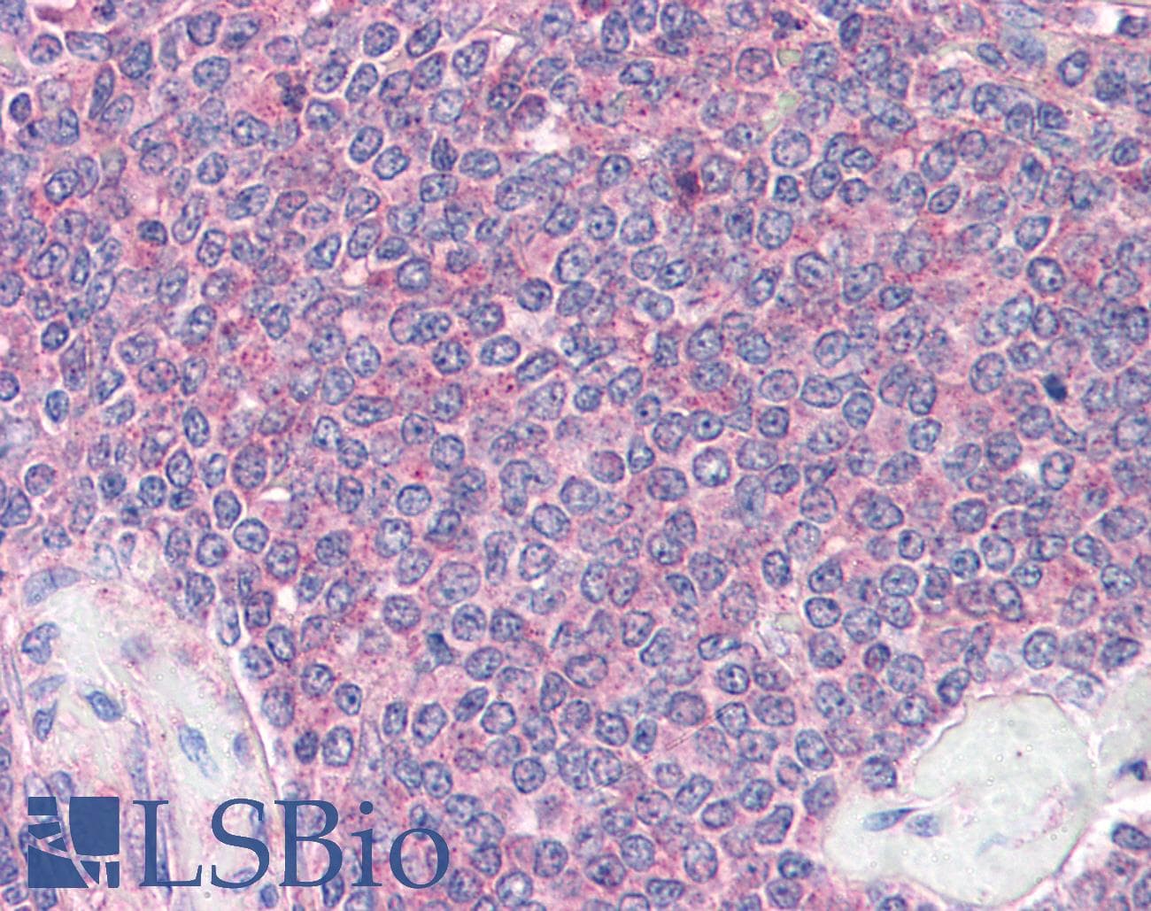 IHC-plus™ Polyclonal Rabbit anti-Human DDX3 / DDX3X Antibody (IHC, WB)