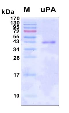Human PLAU / Urokinase / uPA Protein (Recombinant 6His, N-terminus)