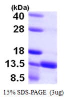 Human S100A16 Protein (Recombinant His)