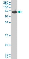 EIF2AK2 / PKR Antibody (clone 1D11)