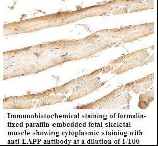 Polyclonal Rabbit anti-Human EAPP Antibody (aa7-192, IHC, WB)