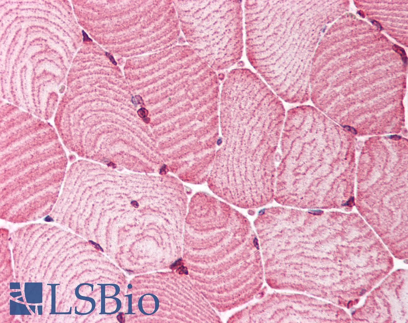 IHC-plus™ Polyclonal Rabbit anti-Human MCAD / ACADM Antibody (IHC, WB)