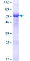 Human PHYHIPL Protein (Recombinant GST)