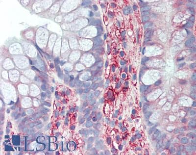 IHC-plus™ HLA-B Antibody